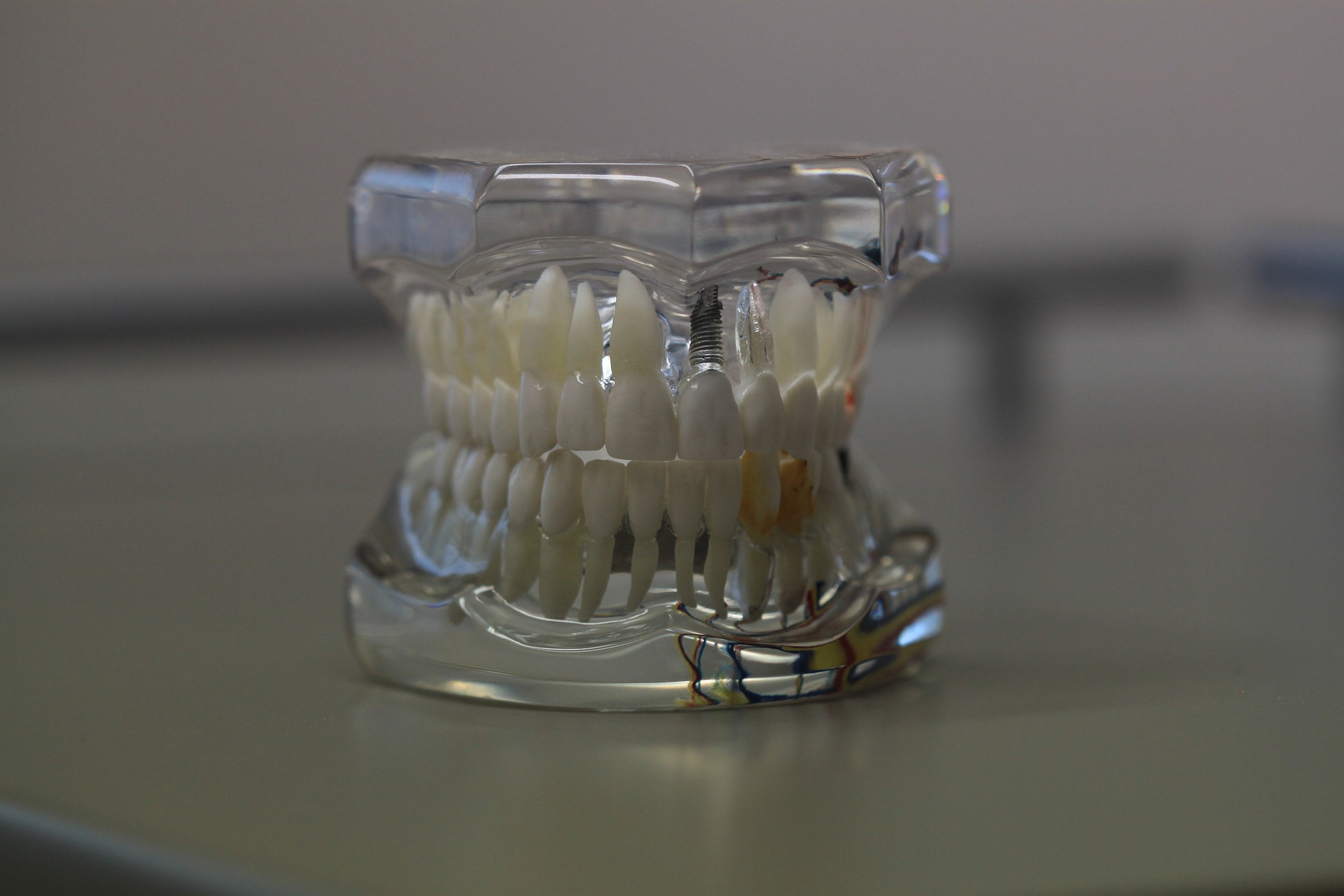Recomendaciones para los pacientes con prótesis dental removible