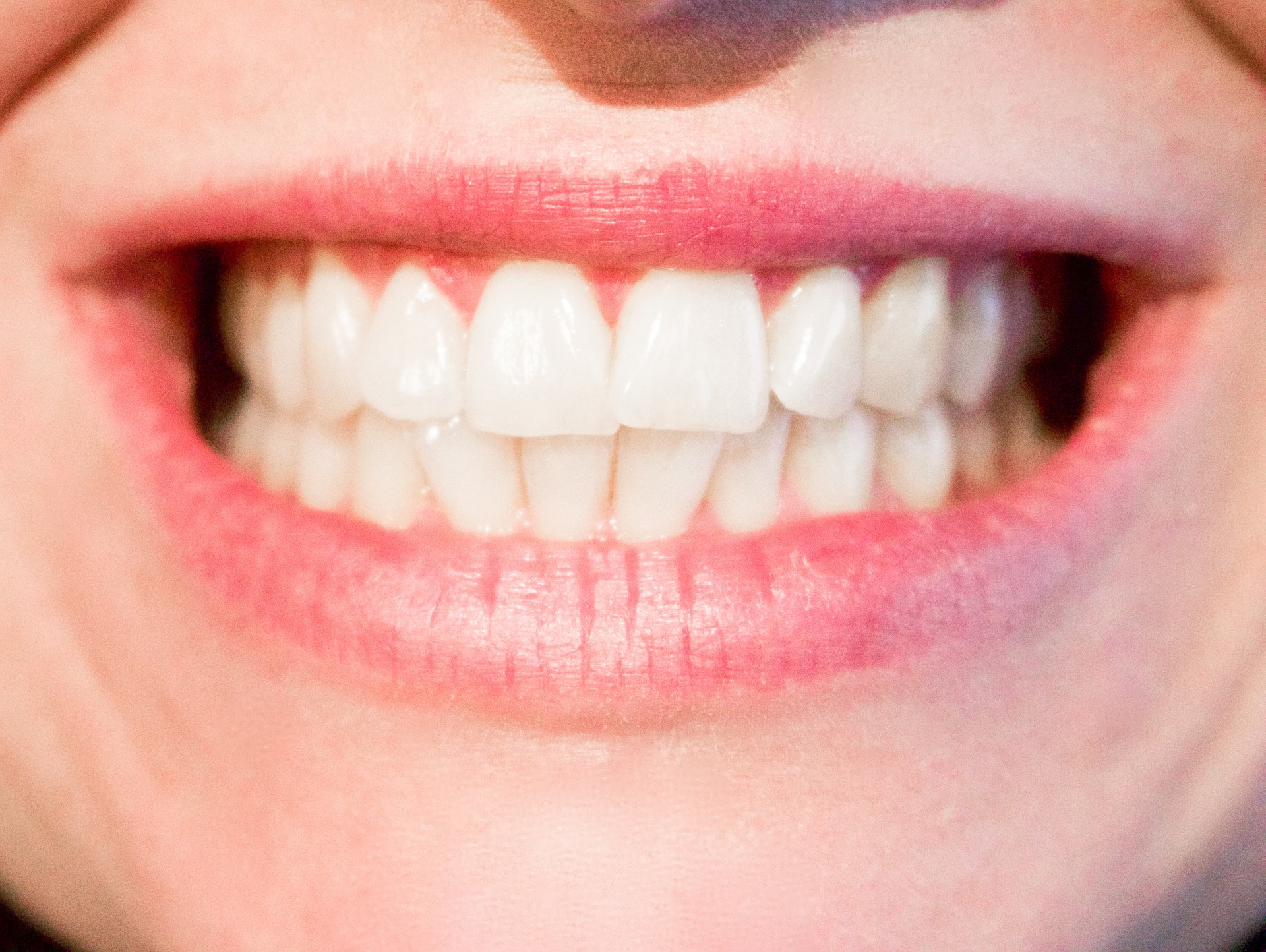 Dental clinic tips: 7 consejos alimentarios para no perder el color en los dientes